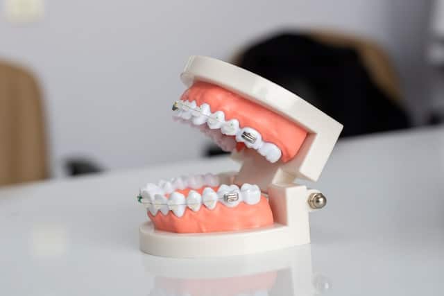 Porównujemy ceny implantów zębowych – warto inwestować w nowy uśmiech?